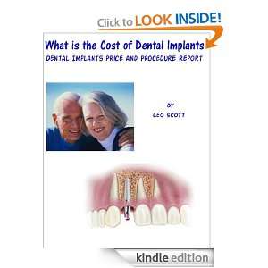 What is the Cost of Dental Implants Dental Implants Price and 