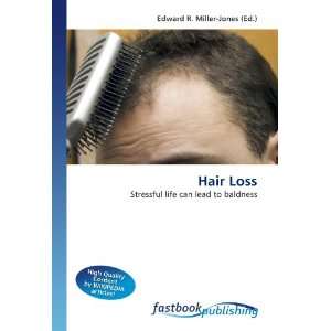  Hair Loss Stressful life can lead to baldness 