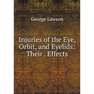   Injuries of the Eye, Orbit and Eyelids George Lawson Books