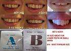 TEETH GAP BANDS   ORTHODONTIC BANDS  3 SIZES  HEAVY  